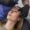 Facelifting Procedure