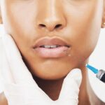 receiving expert lip fillers kansas city