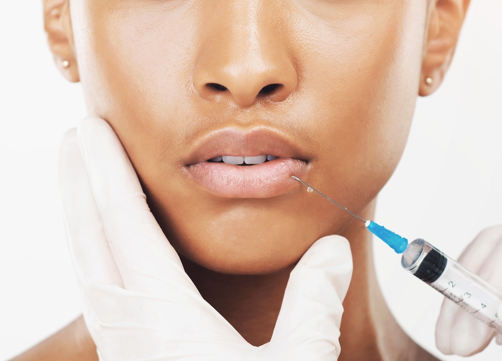 receiving expert lip fillers kansas city