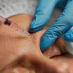 Close up of dermal fillers being injected to forehead