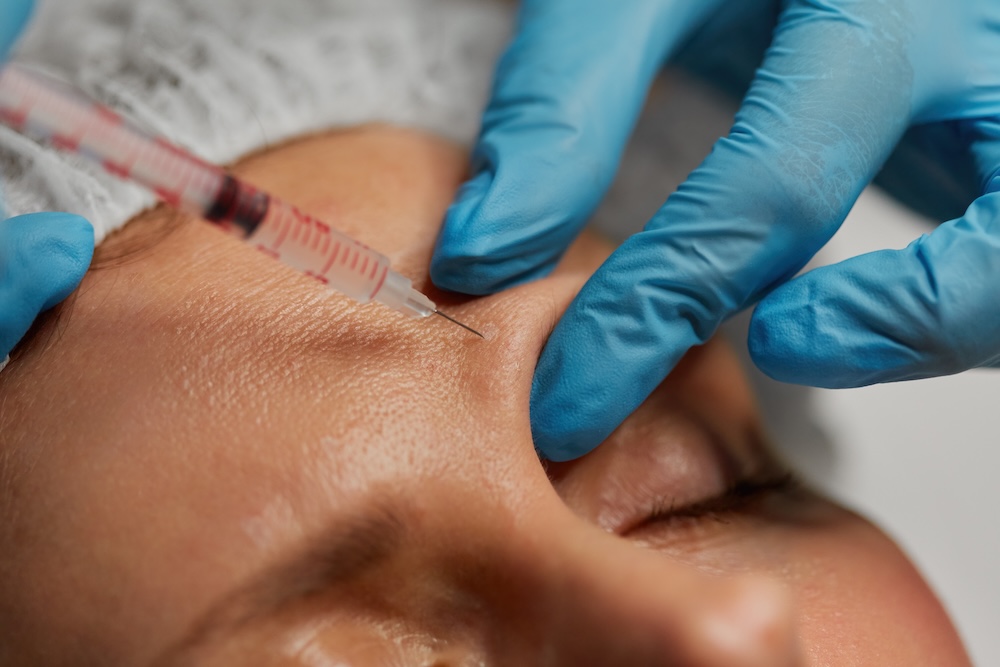 Close up of dermal fillers being injected to forehead