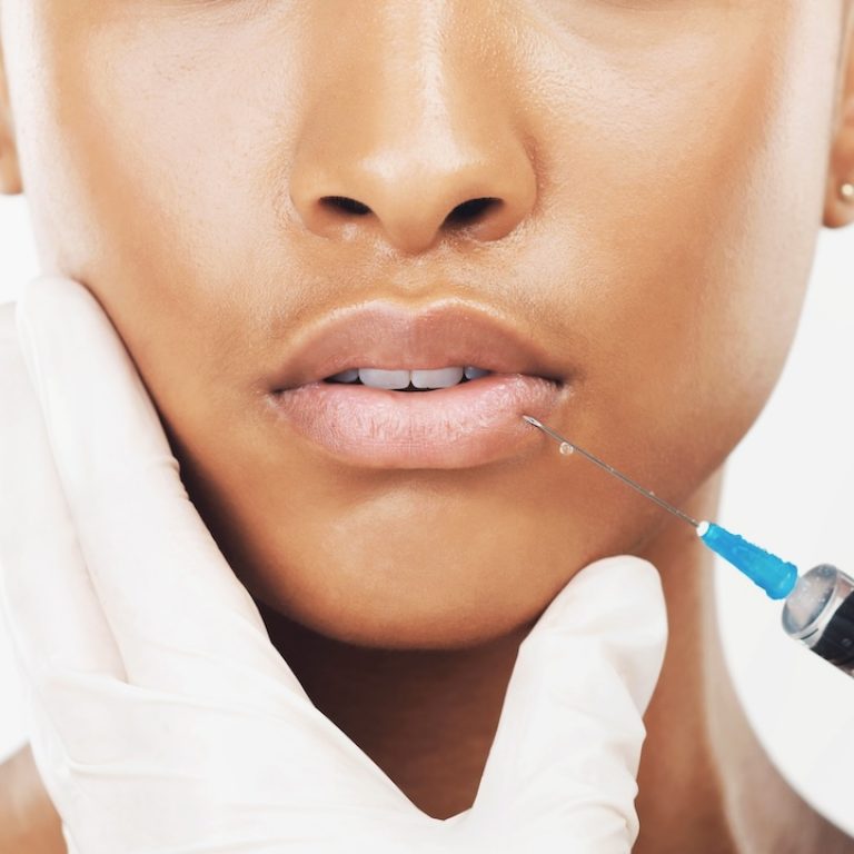 receiving expert lip fillers kansas city